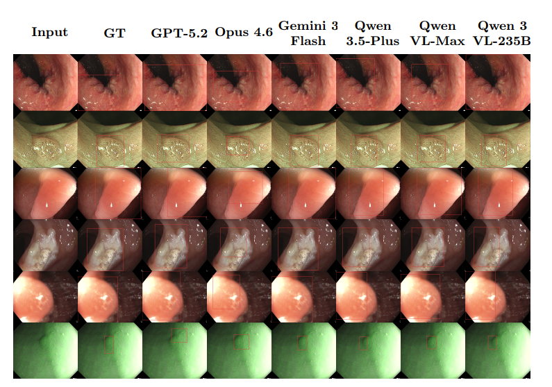 Detection Comparisons