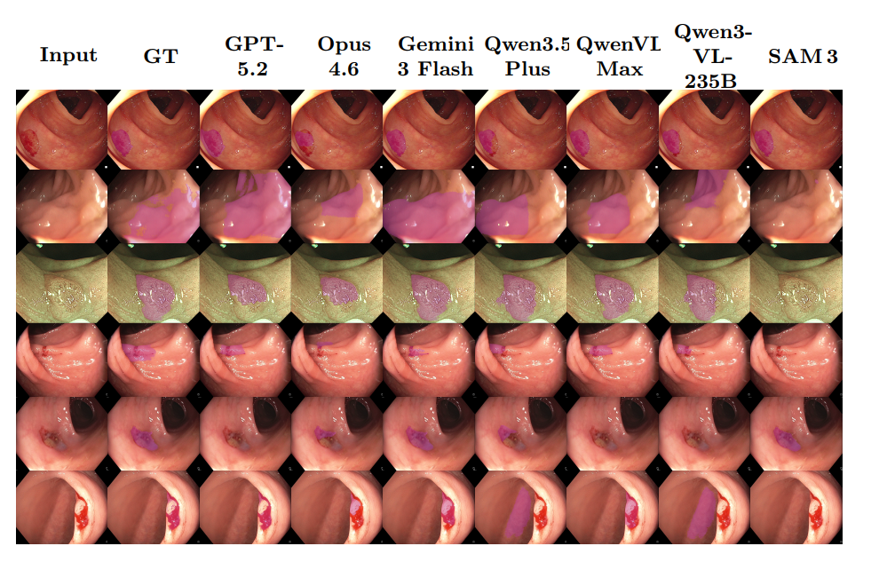 Segmentation Comparisons