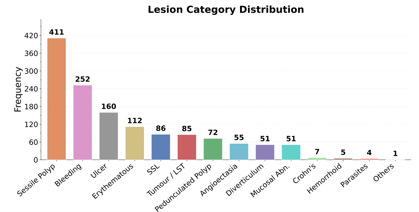 Lesion Distribution and Qualitative Results