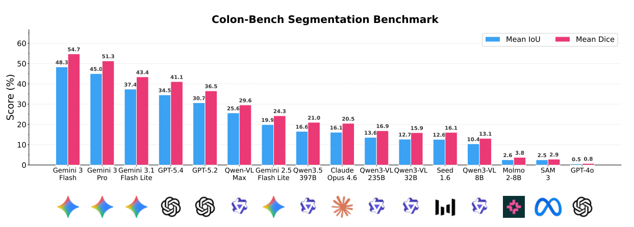 Segmentation Benchmark Results